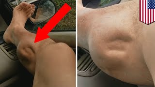 Muscle cramps explained What’s causing this guy’s leg to spasm horrifically  TomoNews [upl. by Diao]