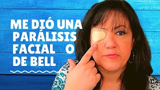 1 Me dió parálisis facial o de Bell tratamiento [upl. by Enahc]