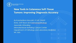 New Tools in Cutaneous Soft Tissue Tumors Improving Diagnostic Accuracy [upl. by Rudolf]