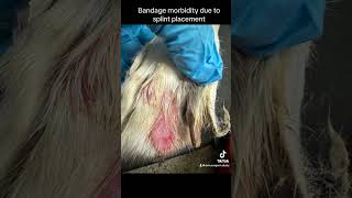 Bandage morbidity [upl. by Prudi]