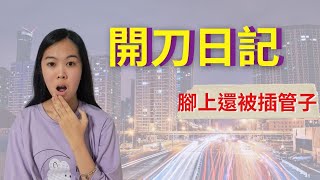 第一次開刀很緊張公開我的開刀經歷 [upl. by Baugh322]