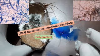 LPCB tease mount procedure and observation under the Microscope [upl. by Kcid]