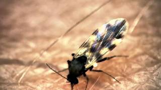 Midge bites through presenters arm  The Secret Life of Midges  BBC One [upl. by Aushoj]