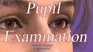 Pupil Examination  RAPD  Pupillary Light Reflex  Marcus Gunn Pupil  Swinging flashlight Test [upl. by Domenech]