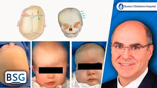 Craniosynostosis Grand Rounds  Neurosurgery Course  February 21 2023 [upl. by Ozner832]