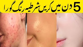 Beauty cream for face  acne treatment cream  Blackhead treatment  Open pores treatment [upl. by Lars]