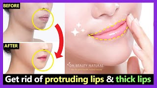 How to get rid of Protruding Mouth and Lips naturally  Make Thick lips to Thin lips with exercises [upl. by Aibsel]