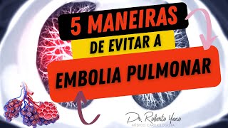 5 maneiras de evitar a Embolia Pulmonar Tromboembolismo pulmonar é grave [upl. by Llenreb703]