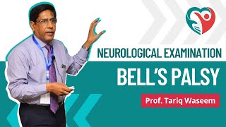 Bells Palsy  Neurological Examination by ProfTariqWaseem medical education medicalexamination [upl. by Aisak]