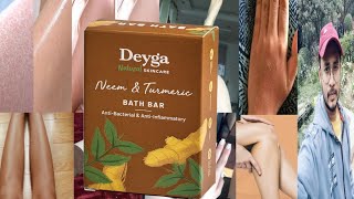 Deyga Neem Turmeric Bath Bar  Honest Review [upl. by Arlan]