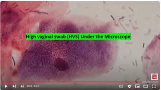 HVS under the microscope [upl. by Urbani149]