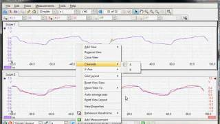 PicoScope 6 Viewing Waveforms [upl. by Nirtiac]