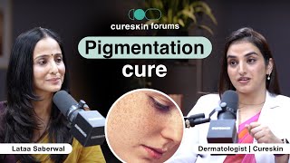 Pigmentation questions answered by Cureskin doctor  Cureskin forums with lataasaberwal [upl. by Erastatus]