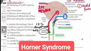 Horner Syndrome Causes Symptoms amp Treatment ophthalmology 26  First Aid USMLE Step 1 [upl. by Amaj]