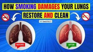 How Smoking Cigarettes Damages Lungs Ways To Detox Your Lungs [upl. by Mcallister269]