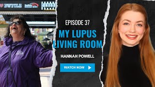 My Lupus Living Room  Episode 37  Hannah Powell [upl. by Shelley130]