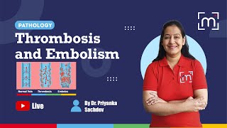 Thrombosis and Embolism with Dr Priyanka Sachdev [upl. by Nolyk813]