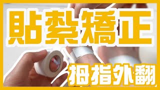 拇指外翻自我貼紮｜3M膠布也可以？運動貼紮固定你的拇指外翻！安心無痛跑步，不再讓疼痛打擾你！ [upl. by Hebert]