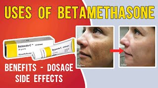 What is Uses of Betamethasone Betaderm Betnovate  betnovate c skin cream  Benefits Dosage [upl. by Barrie]