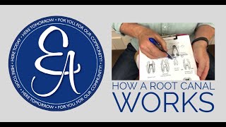 How a Root Canal Works  Endodontic Associates of Central Texas [upl. by Albin]