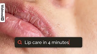 How To Get Rid Of Chapped Lips  Lip Care 101  From Exfoliating To Moisturizing ✨ [upl. by Alicsirp]