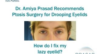 How to Fix a Lazy Eyelid [upl. by Annaid]