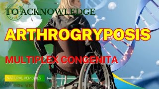 Arthrogryposis Multiplex Congenita  Natural Remedies [upl. by Anelys]