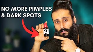 Simple Solution For Pimples Dark spots Pigmentation  Bearded Chokra [upl. by Ardnos]