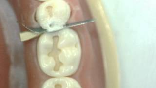 Cl II Cavity preparation Lower 2nd Premolar GV Black Dr Ahmed Sleibi [upl. by Gimpel116]