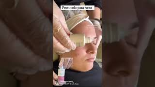 Protocolo para Acne Tulipia [upl. by Ettenirt]