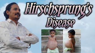 Hirschsprungs disease dha moh prometric [upl. by Aihseya60]