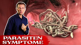 Die besten Kräuter gegen Parasiten  Parasiten Symptome  Dr Berg Deutsch [upl. by Eelyak]