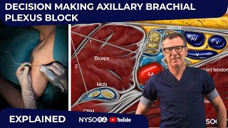 Axillary Block Decision Making Explained  Crash course with Dr Hadzic [upl. by Hoover337]