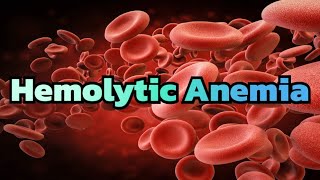 Hemolytic Anemia updated 2023  CRASH Medical Review Series [upl. by Elizabet]