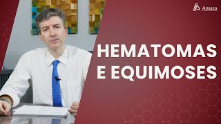 Roxos nas pernas Hematomas Equimoses e Petéquias [upl. by Aibun]