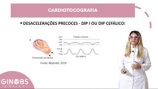 Aprenda a interpretar a cardiotocografia [upl. by Shipman490]