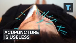 Acupuncture is useless [upl. by Hartill]