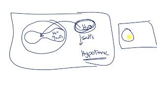 7 Normocytic Anemia Part 23  Rest of Intrinsic hemolytic [upl. by Adnolohs]