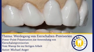 ZahntechnikGRATISWerdegang von EierschalenProvisorien [upl. by Aaren798]