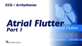 ECG 49  Atrial Flutter 1 [upl. by Tace]