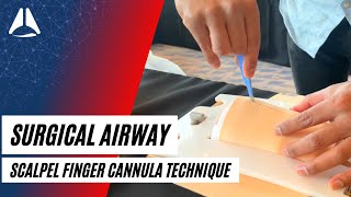 Scalpel Finger Cannula technique in CICO emergencies  Airway Management [upl. by Haines288]