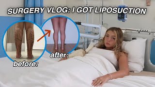 SURGERY VLOG I GOT LIPOSUCTION it was hell [upl. by Ithaman]