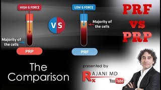 PRF vs PRP We Compare [upl. by Sevein]