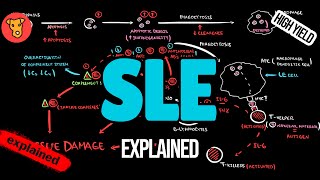SYSTEMIC LUPUS ERYTHEMATOSUS Pathogenesis EULAR Guidlines Classification Treatment [upl. by Atsev]