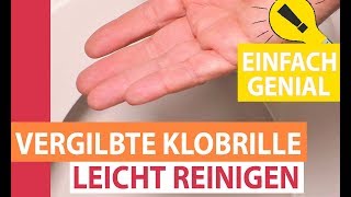 Vergilbte Klobrille leicht reinigen Toilettensitz von gelb nach weiß [upl. by Akerboom83]