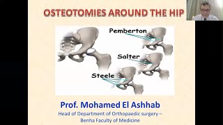 Osteotomies Around Hip  Prof Mohamed El Ashhab [upl. by Clarkson]