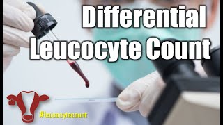 Differential Leucocyte count dlccount dlc leucocyte count bloodsmear whtiebloodcells [upl. by Archambault784]