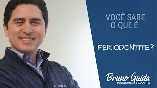 O que é PERIODONTITE Tenho Perda óssea Posso perder os meus dentes Periodontista em Salvador [upl. by Nyledaj364]