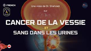 Cancer de la Vessie  Signes Précoces Symptômes et Sang dans les Urines Expliqués [upl. by Banks]