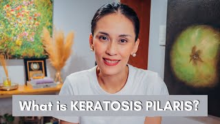 What is Keratosis Pilaris and how to Treat it  Dr Gaile RobredoVitas [upl. by Abbye]